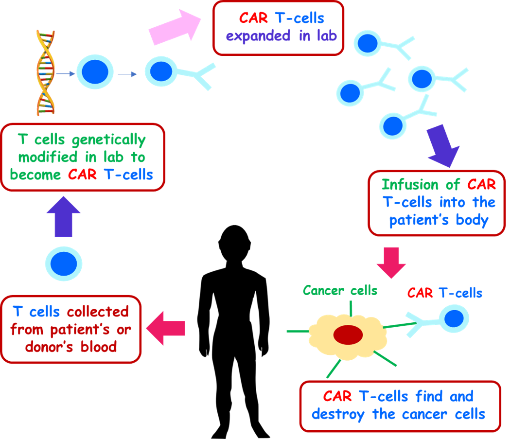 A schematic diagram illustrating the treatment process of CAR T cell therapy