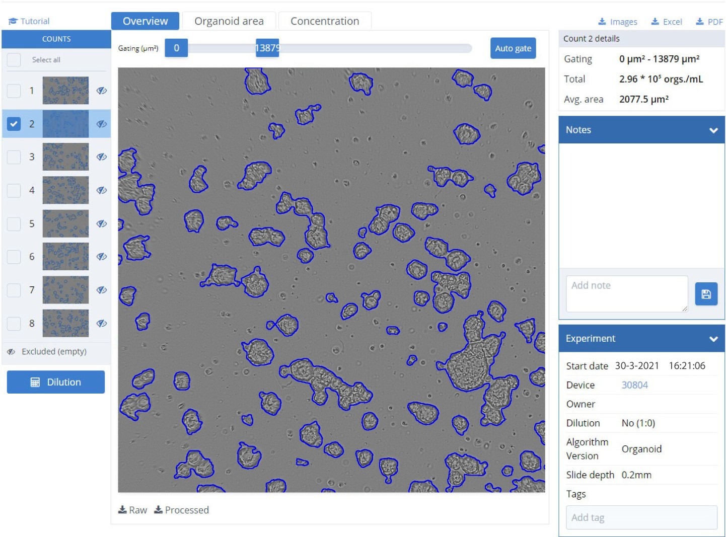 Organoid counting module software interface