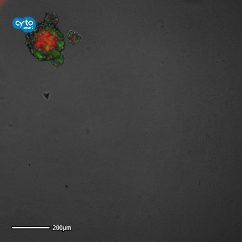 Cancer spheroid formation tracking over time with imaging platform