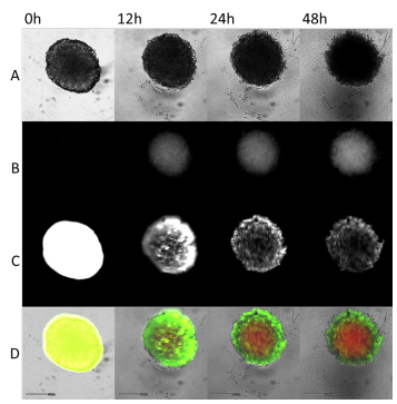 Cancer spheroids under fluorescent imaging