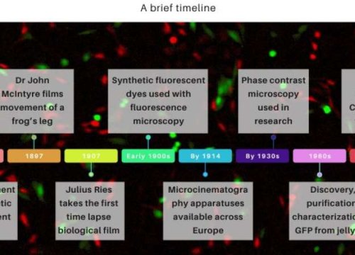 Fluorescence live-cell imaging synopsis
